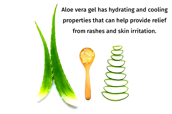 Can aloe vera help hives?