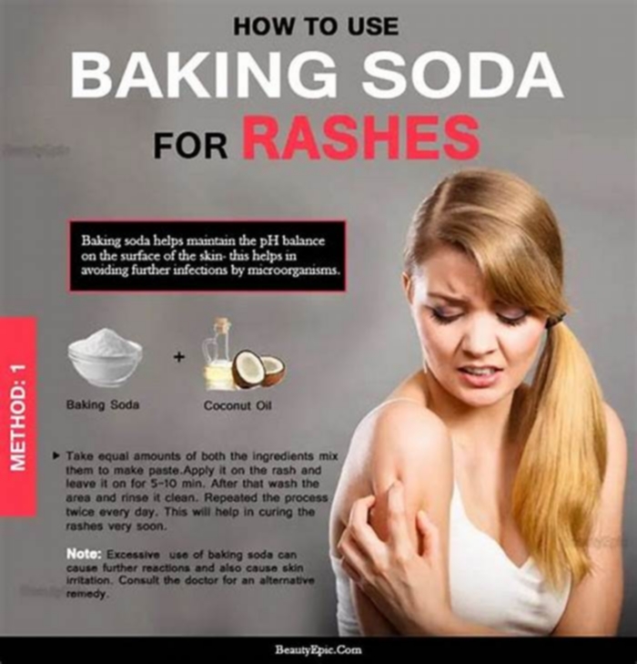 Can baking soda stop itching