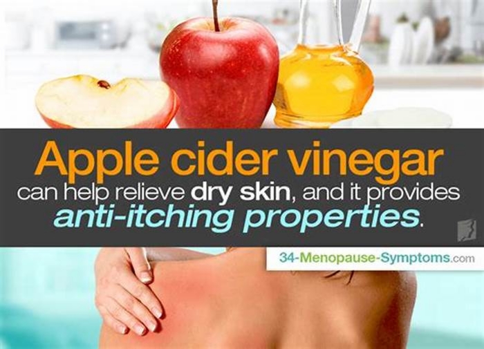 Does vinegar stop itching