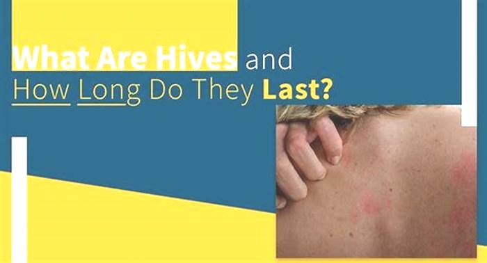 How long do hives from grass last