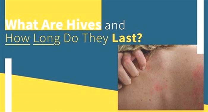 How long does it take for hives to stop itching