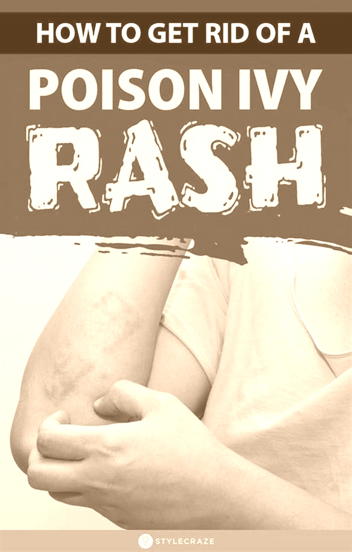 How to get rid of a rash overnight