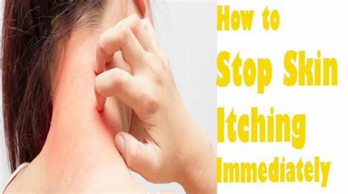 How to stop itching immediately