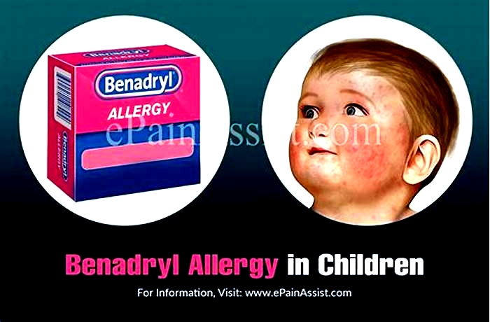 What to take instead of Benadryl for an allergic reaction?