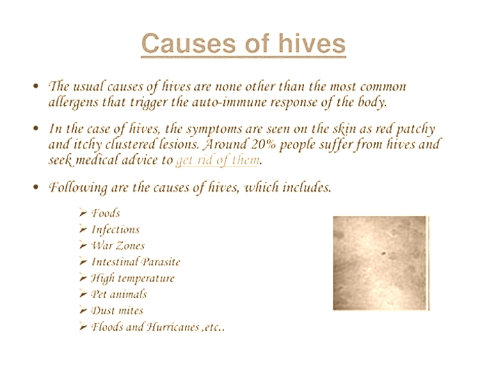 Which deficiency causes hives