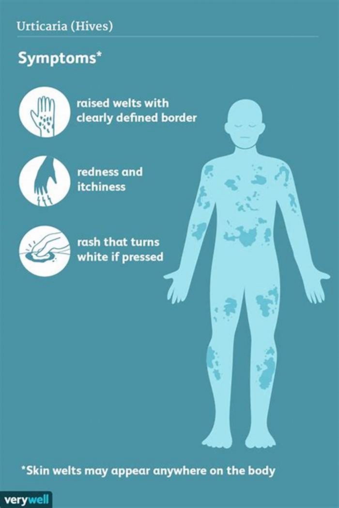 Why do hives get worse at night?