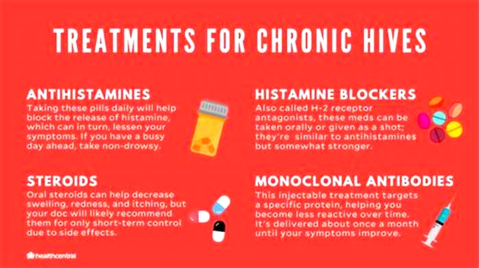 Why won t my hives go away with antihistamines?