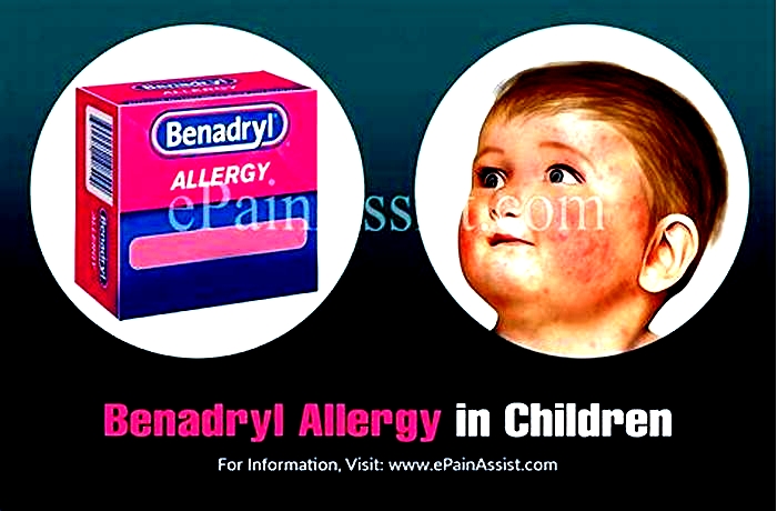 Will hives come back after Benadryl?